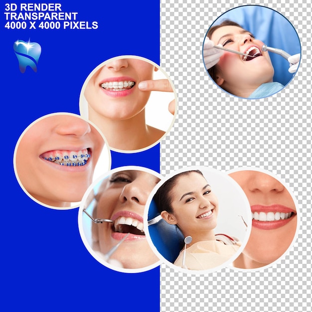 Traitement dentaire Braces dentaires Implant dentaire Observation dentaire Vérification dentaire Douleurs dentaires Dentiste