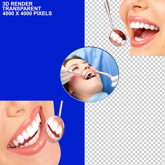 PSD traitement dentaire braces dentaires implant dentaire observation dentaire vérification dentaire douleurs dentaires dentiste