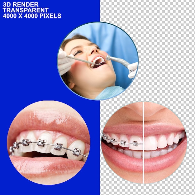 Traitement dentaire Braces dentaires Implant dentaire Observation dentaire Vérification dentaire Douleurs dentaires Dentiste