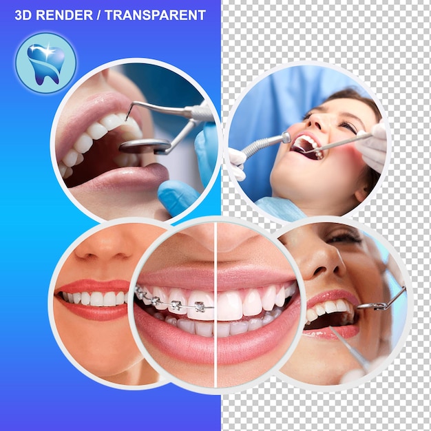 Transformez votre sourire Les derniers implants dentaires et les soins dentaires experts pour des dents saines