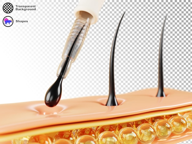 Transplante de cabelo 3d método fue render banner Cabelo com folículos e instrumento médico implantação de enxerto no canal Transplante de tratamento de calvície e conceito de restauração