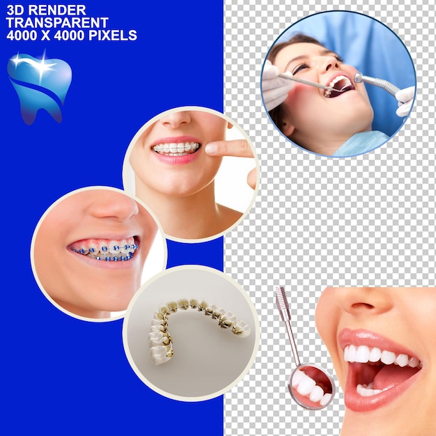 Tratamento dentário Braces dentários Implante dentário Observação dentária Revisão dentária Dor dentária