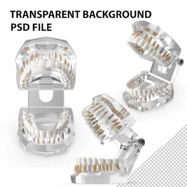 Typodont dentaire transparent avec implants dentaires PNG
