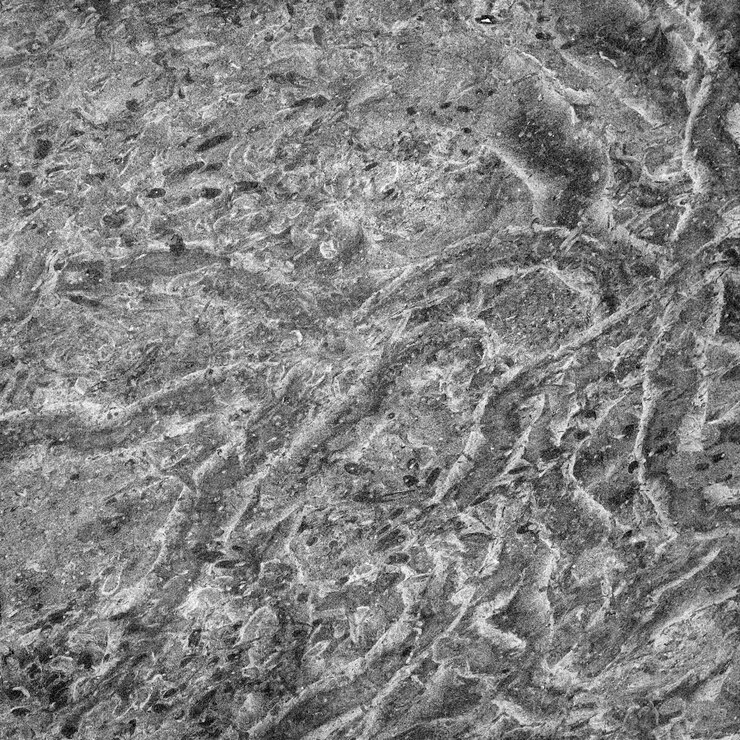 PSD vista microscopica del tessuto che mostra cellule e fibre