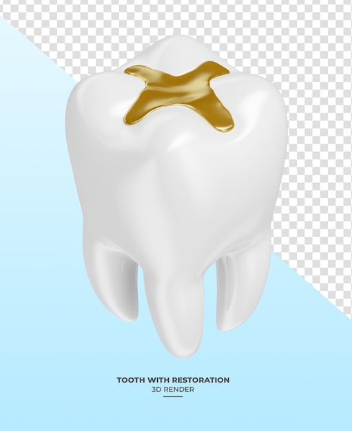 Zahn mit Restaurierung in 3D-Rendering mit transparentem Hintergrund