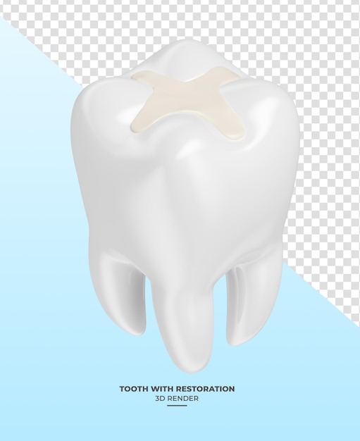 Zahn mit Restaurierung in 3D-Rendering mit transparentem Hintergrund