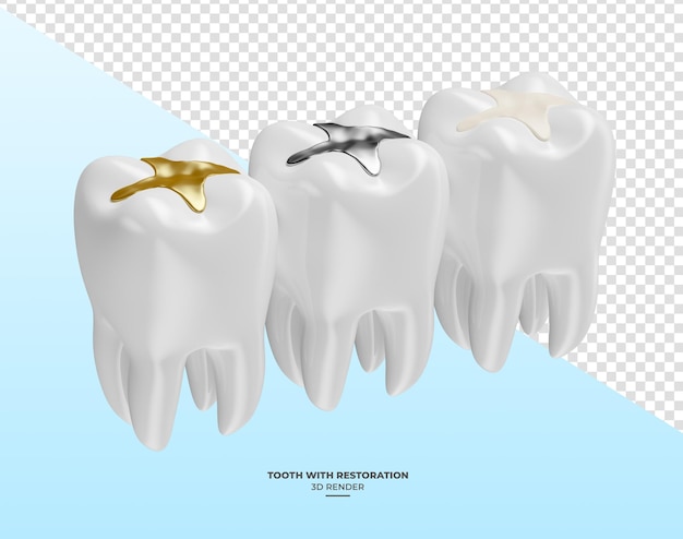 Zahn mit Restaurierung in 3D-Rendering mit transparentem Hintergrund