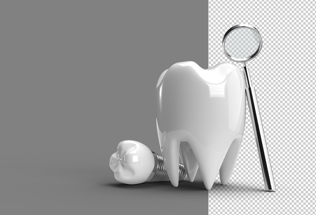 Zahnimplantate Chirurgie Konzept 3D-Rendering transparente Psd-Datei