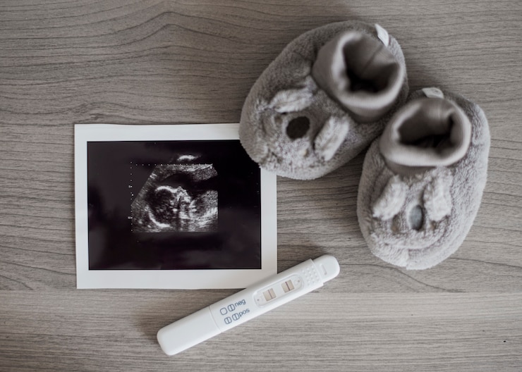 Ücretsiz Fotoğraf cute little shoes and x ray photo