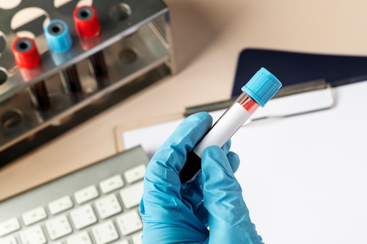 Ücretsiz Fotoğraf surgeon holding a blood test