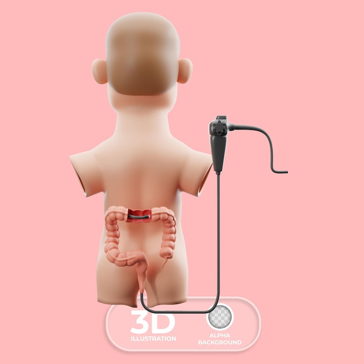 Ücretsiz PSD colonoscopy bowel examination 3d illustration