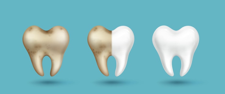 Ücretsiz Vektör realistic tooth dirty gray and clean white