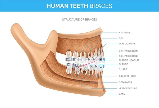 Vecteur gratuit accolades de dents humaines infographie réaliste