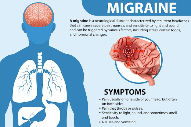 Vecteur gratuit affiche informative de migraine