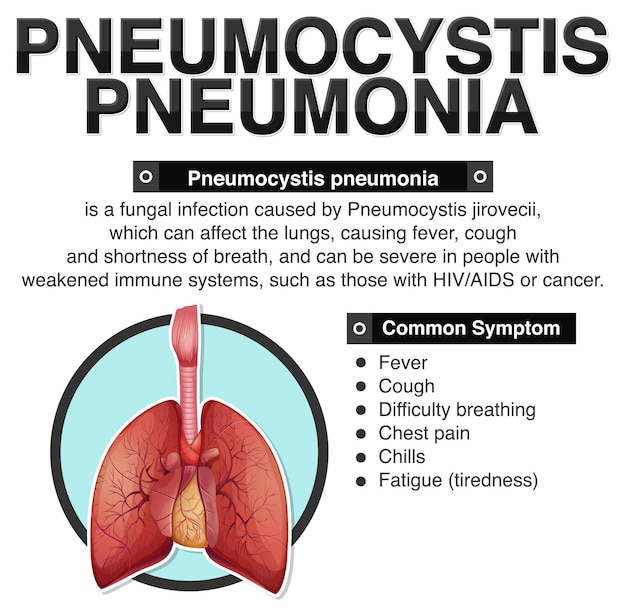 Vecteur gratuit affiche informative sur la pneumonie à pneumocystis