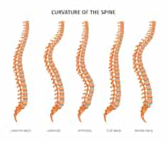 Vecteur gratuit anatomie de la structure de la colonne vertébrale ensemble d'images isolées avec lordose dorsale saine cyphose dos plat et rond illustration vectorielle
