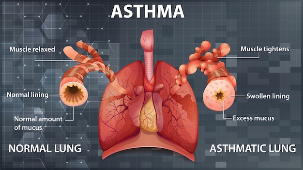 Vecteur gratuit comparaison d'un poumon sain et d'un poumon asthmatique