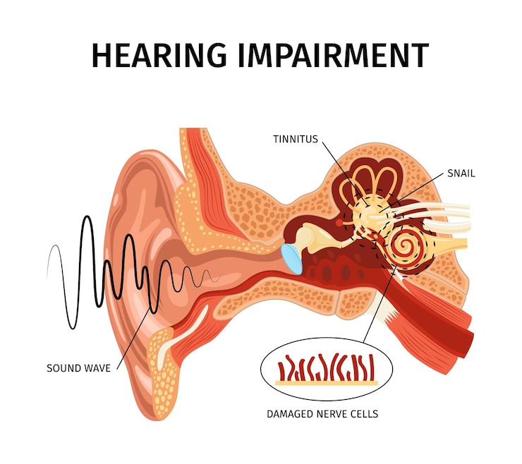 Vecteur gratuit composition d'acouphènes d'oreille d'anatomie réaliste avec vue sur les organes internes sonores avec pointeurs et illustration vectorielle de légendes de texte modifiables