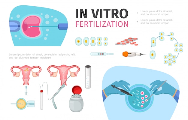 Composition de fécondation in vitro à plat avec procédure de préparation du sperme développement de l'embryon et transfert d'outils médicaux pour le processus d'insémination