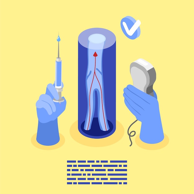 Composition De Fond Isométrique Variqueuse Avec Texte Et Vue De La Structure Veineuse Avec Des Mains Médicales Tenant Des Outils Illustration Vectorielle