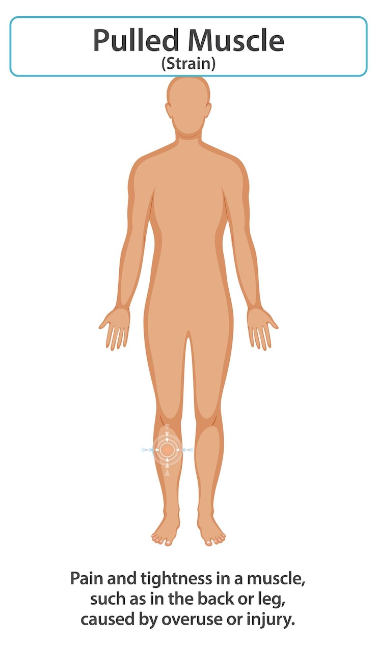 Vecteur gratuit comprendre la tension musculaire et la récupération
