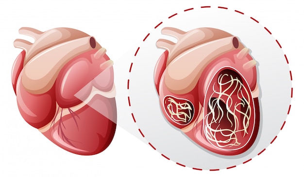 Concept de ver coeur magnifié
