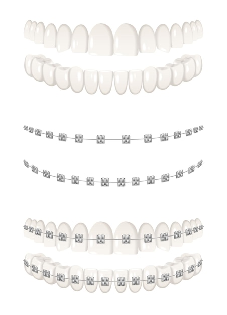 Dents Dentaires Icônes Réalistes Définies Illustration Vectorielle Isolée