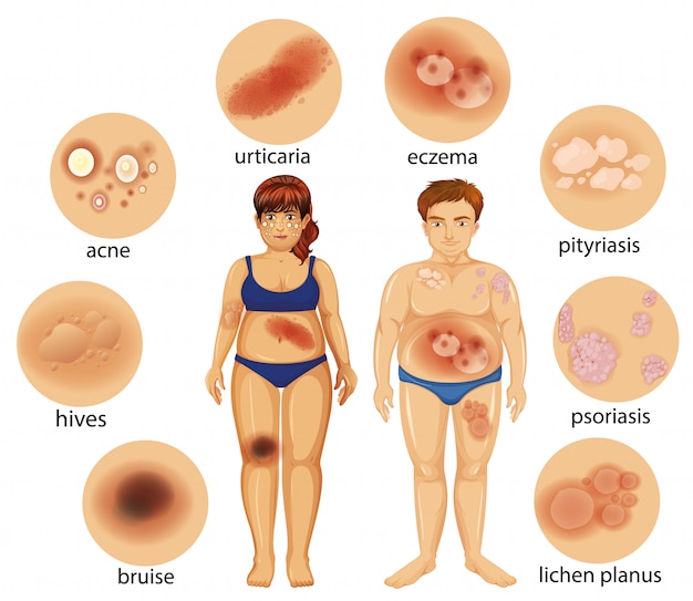 Vecteur gratuit diagramme montrant différentes maladies de la peau