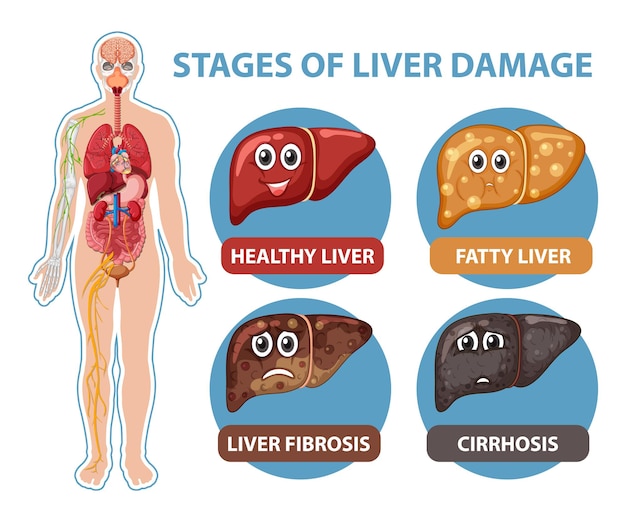 Diagramme Montrant Les étapes Des Dommages Au Foie