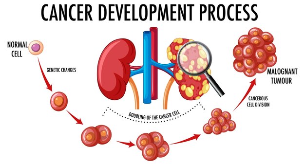 Diagramme Montrant Le Processus De Développement Du Cancer