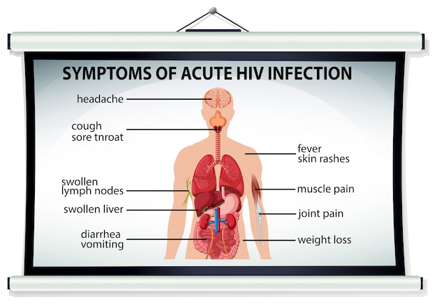 Vecteur gratuit diagramme montrant les symptômes d'une infection aiguë par le vih