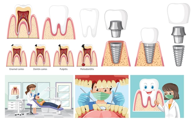 Vecteur gratuit ensemble de tous les types de dents sur fond blanc