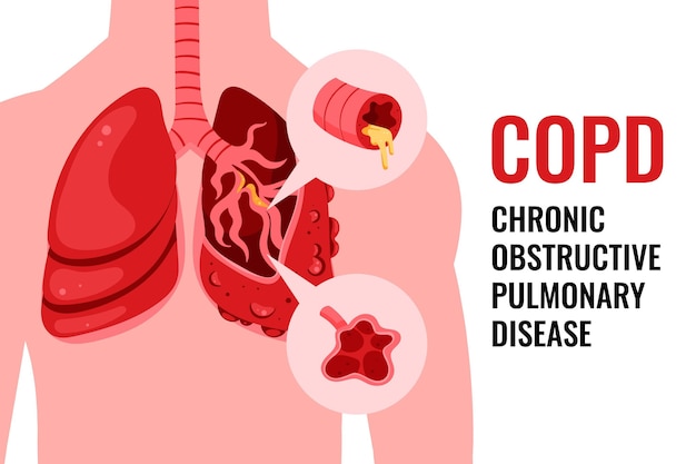 Fond De Copd Plat Dessiné à La Main