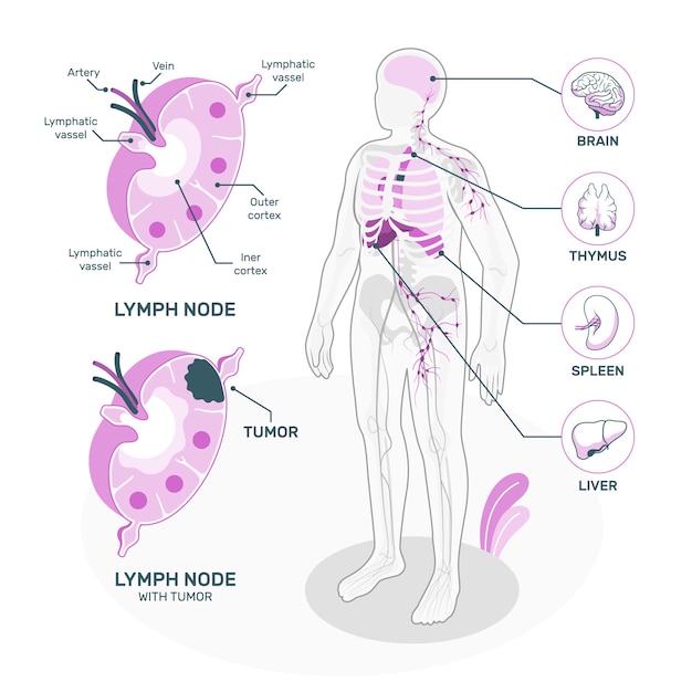 Vecteur gratuit illustration de concept de lymphome
