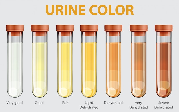 Vecteur gratuit illustration du nuancier de l'urine