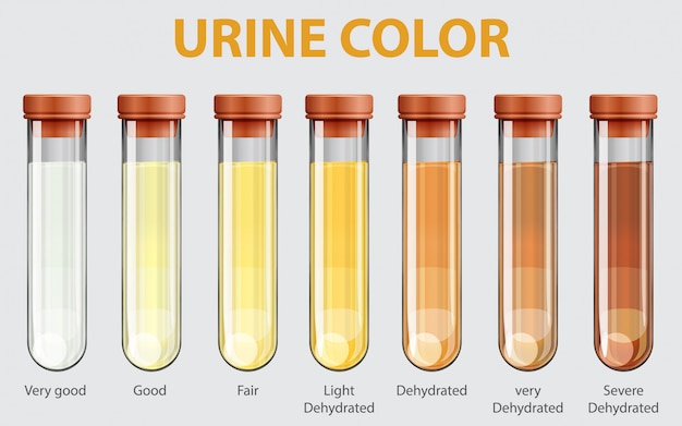 Illustration du nuancier de l'urine