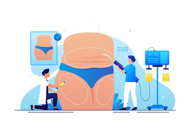 Vecteur gratuit illustration de liposuccion dégradée