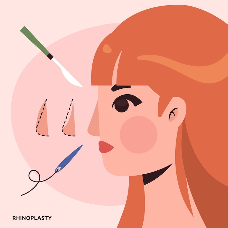 Vecteur gratuit illustration de rhinoplastie design plat dessiné à la main