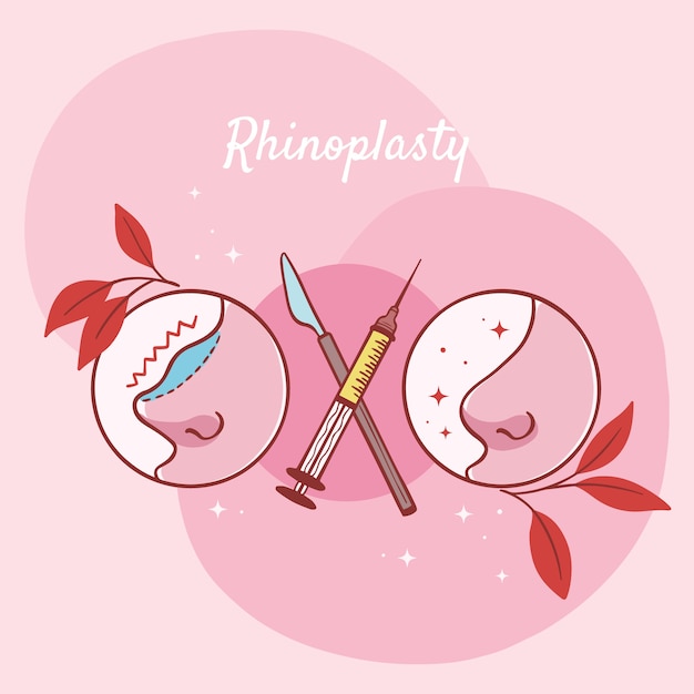 Vecteur gratuit illustration de rhinoplastie dessinée à la main