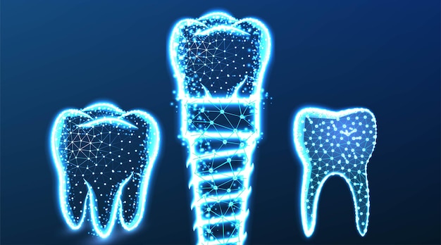 Vecteur gratuit implant dentaire dentaire illustration vectorielle de conception de maillage filaire low poly abstraite