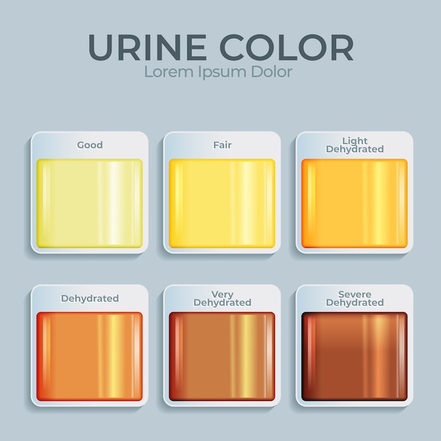 Infographie De La Couleur De L'urine Dégradée