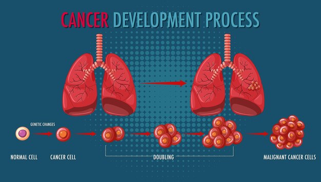 Vecteur gratuit infographie du processus de développement du cancer