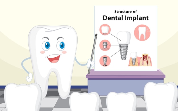 Vecteur gratuit infographie de l'humain dans la structure de l'implant dentaire