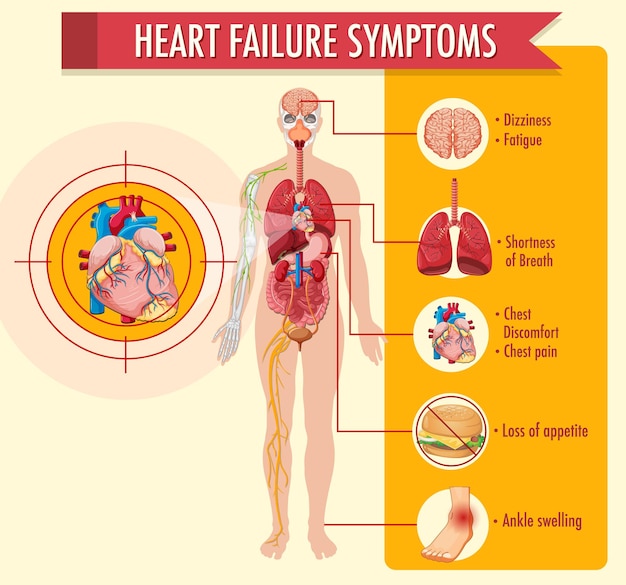Vecteur gratuit infographie d'informations sur les symptômes d'insuffisance cardiaque