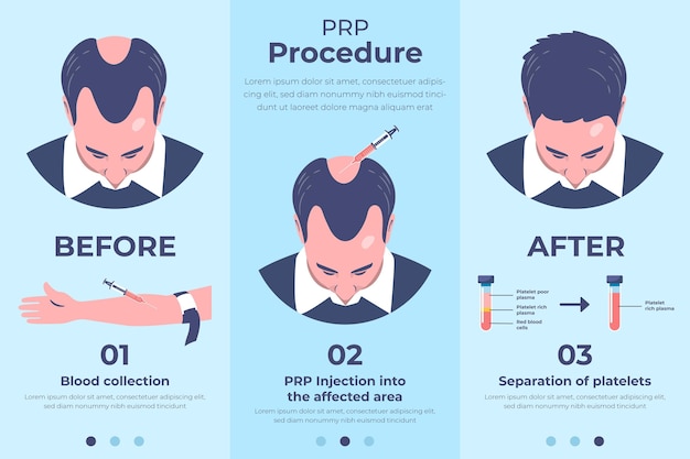 Vecteur gratuit infographie de la procédure prp dessinée à la main