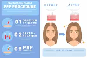 Vecteur gratuit infographie de la procédure prp dessinée à la main