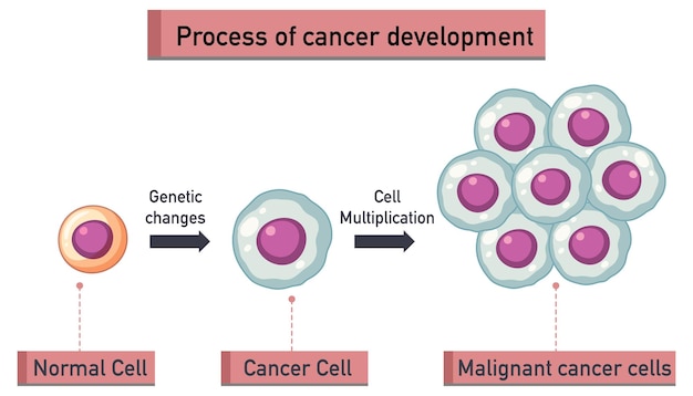 Vecteur gratuit infographie sur le processus de développement du cancer