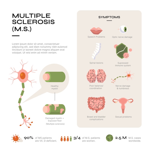 Infographie De La Sclérose En Plaques Design Plat Dessiné à La Main