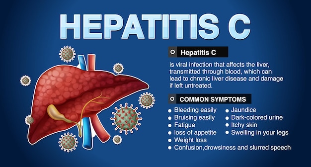 Vecteur gratuit infographie sur les symptômes de l'hépatite c