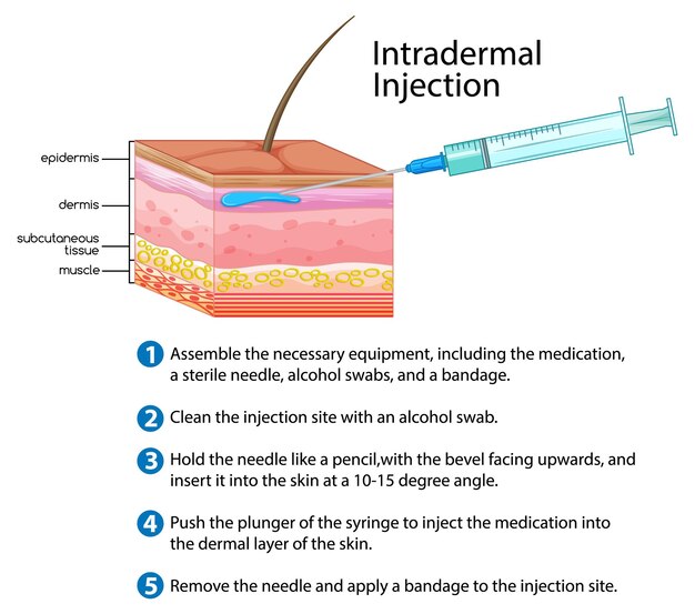 Injection intradermique avec explication